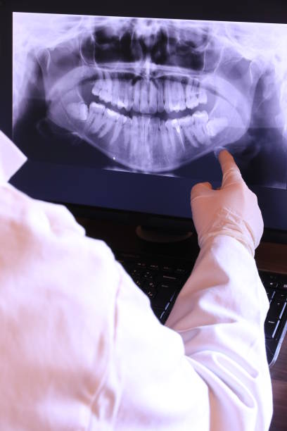 Best Emergency Root Canal Treatment in Pleasantville, IA