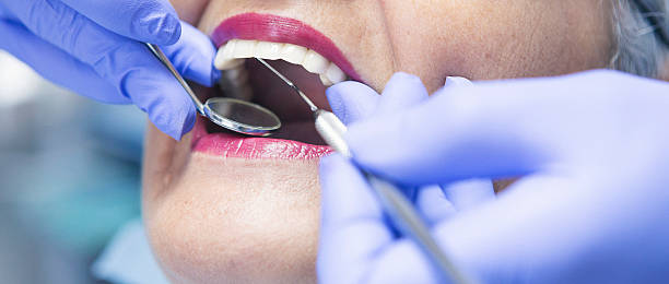 Best Emergency Tooth Extraction in Pleasantville, IA