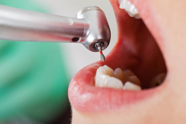 Best Pediatric Emergency Dentist in Pleasantville, IA